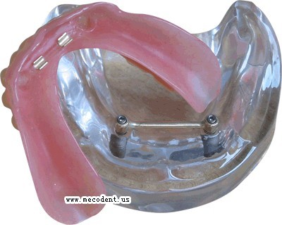 Complete-Dentures 172576